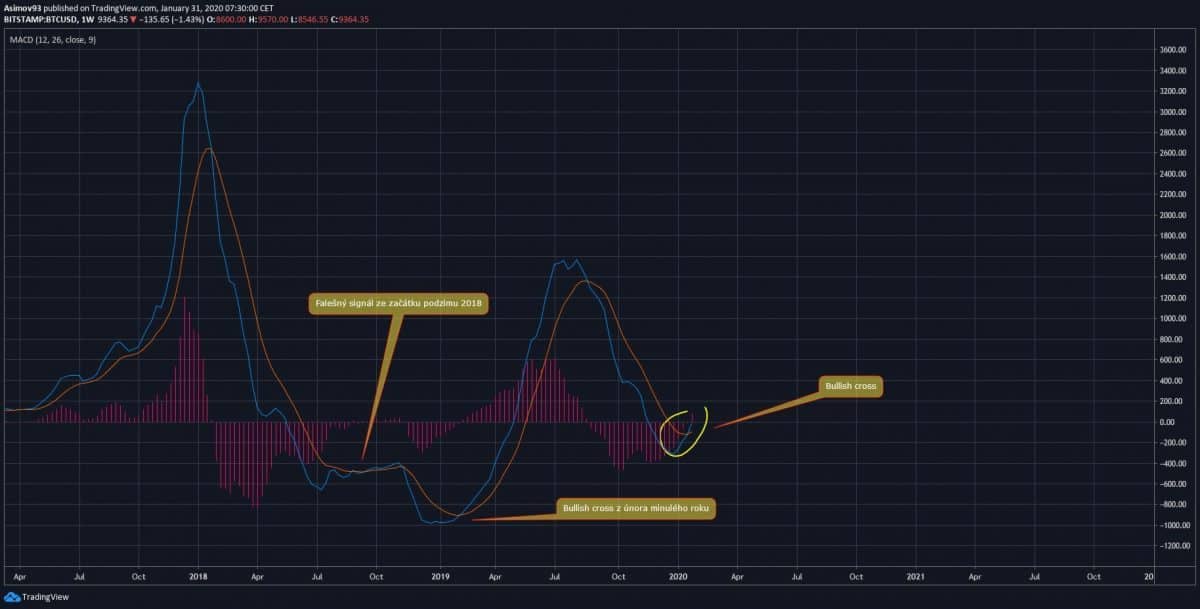 MACD