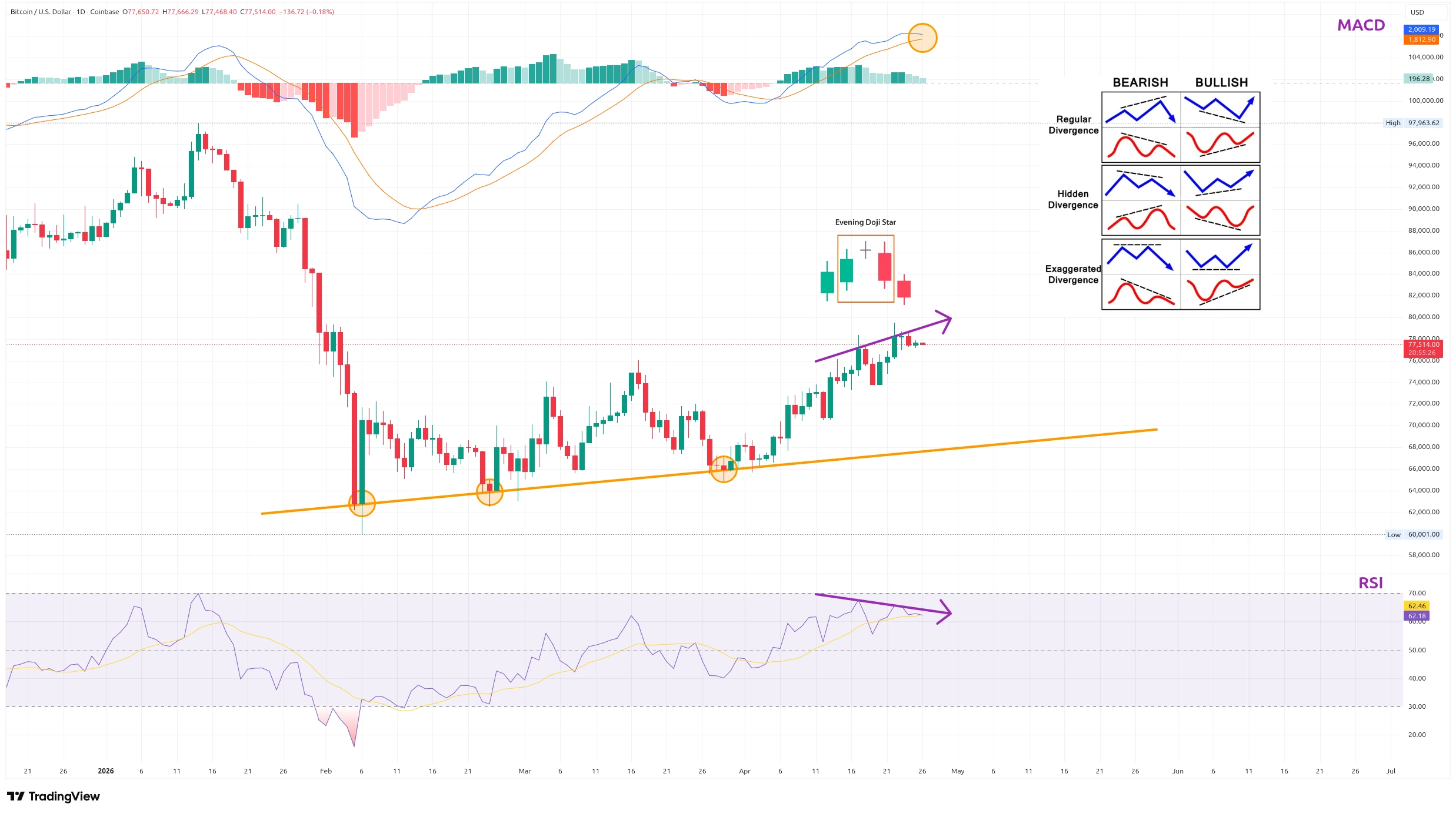 Denní graf s vyznačením medvědí divergence a indikátory RSI a MACD (zdroj: TradingView).